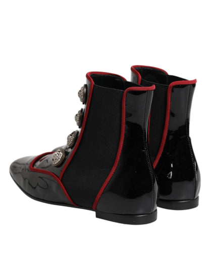 حذاء تشيلسي جاكي أسود بأزرار